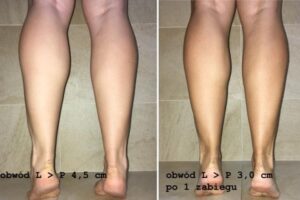 Efektywne sposoby na spalenie mięśni łydek i ich wysmuklenie