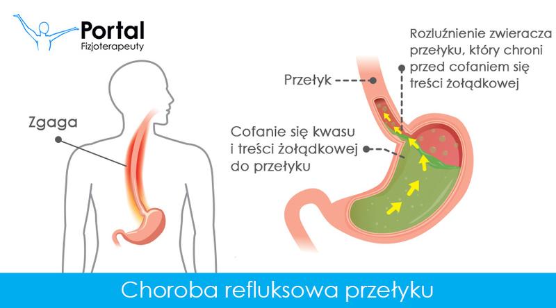 Skuteczne metody na rozluźnienie mięśni przełyku - poradnik dla każdego