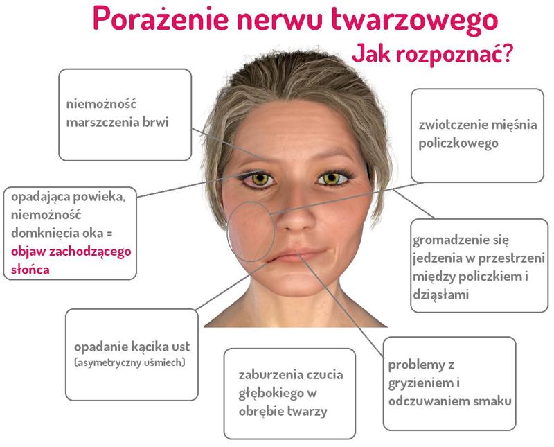 Objawy porażenia mięśni