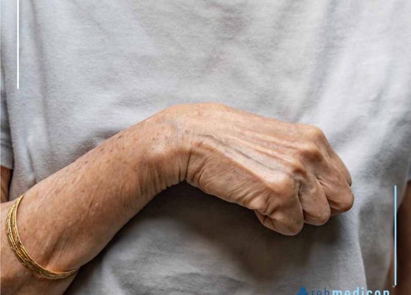 Przykurcz mięśni kręgosłupa objawy