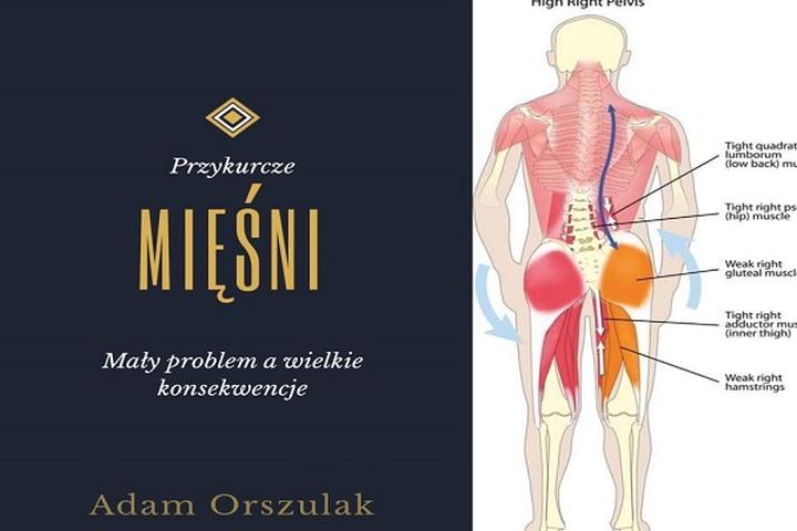 Jak rozpoznać przykurcz mięśni kręgosłupa? Objawy, które warto znać